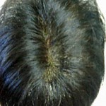 修復事例001：外側