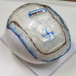 ネット部分の型どり再生